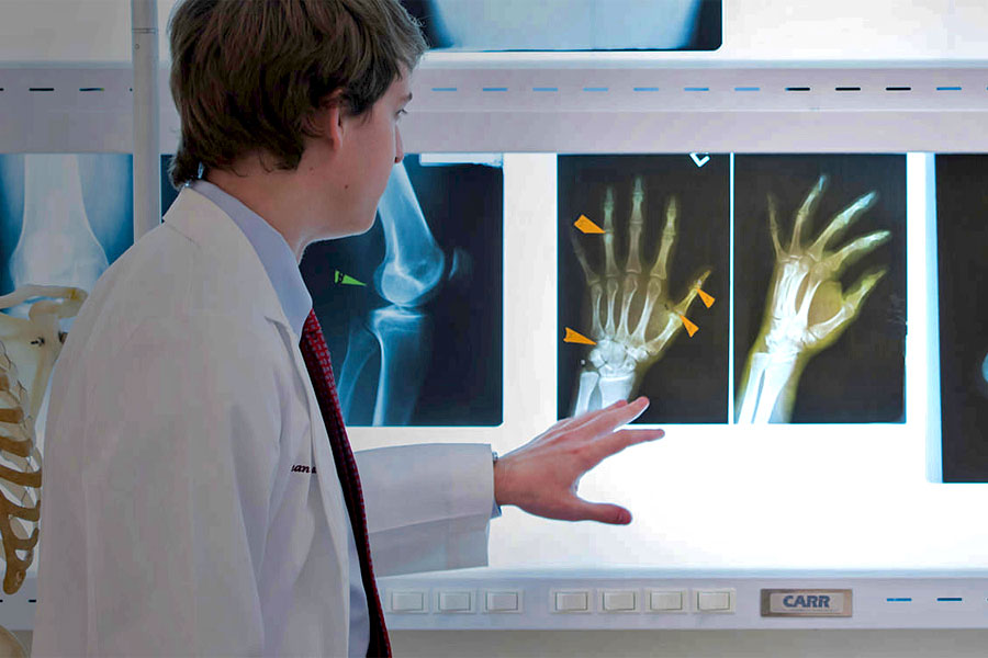 A young professional in a lab coat examines an x-ray of a hand